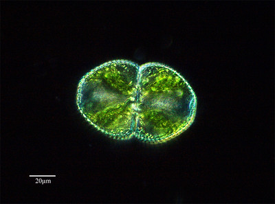 alga unicelular